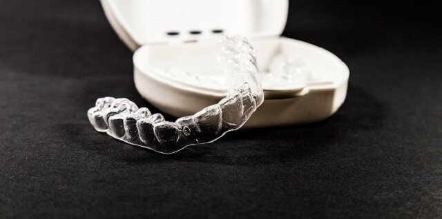 Invisalign blog